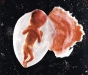 1990-b-feto18 mesi